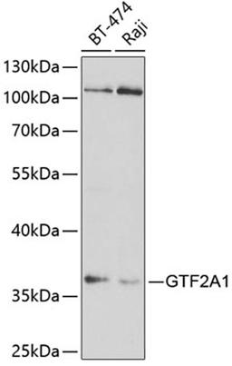 Western blot - GTF2A1 antibody (A5345)