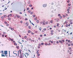 46-252 (3.75ug/ml) staining of paraffin embedded Human Thyroid. Steamed antigen retrieval with citrate buffer pH 6, AP-staining.