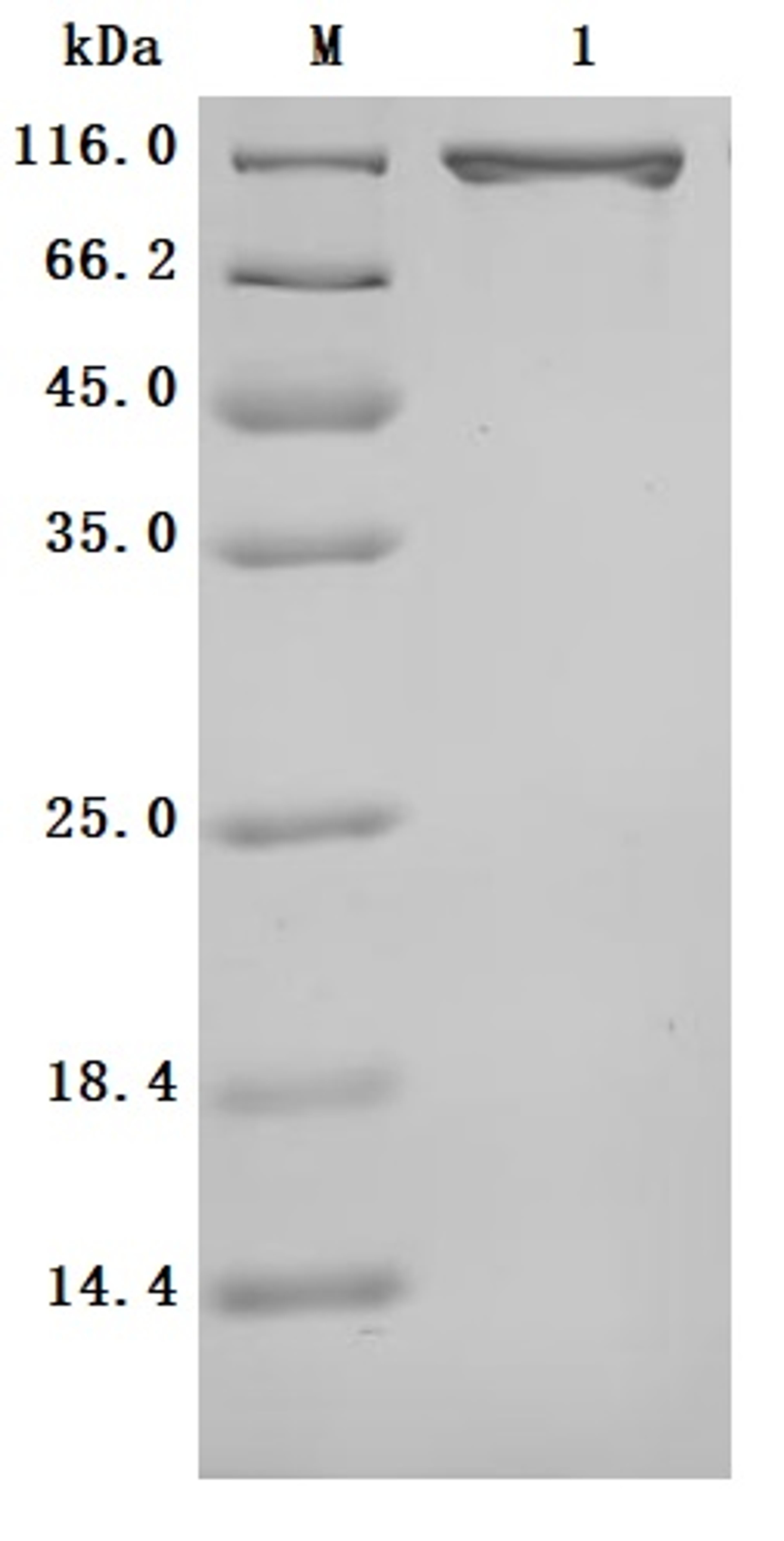 (Tris-Glycine gel) Discontinuous SDS-PAGE (reduced) with 5% enrichment gel and 15% separation gel.