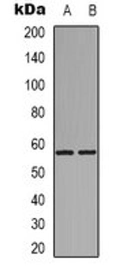 Western blot analysis of Hela (Lane 1), rat muscle (Lane 2) whole cell lysates using GPR101 antibody