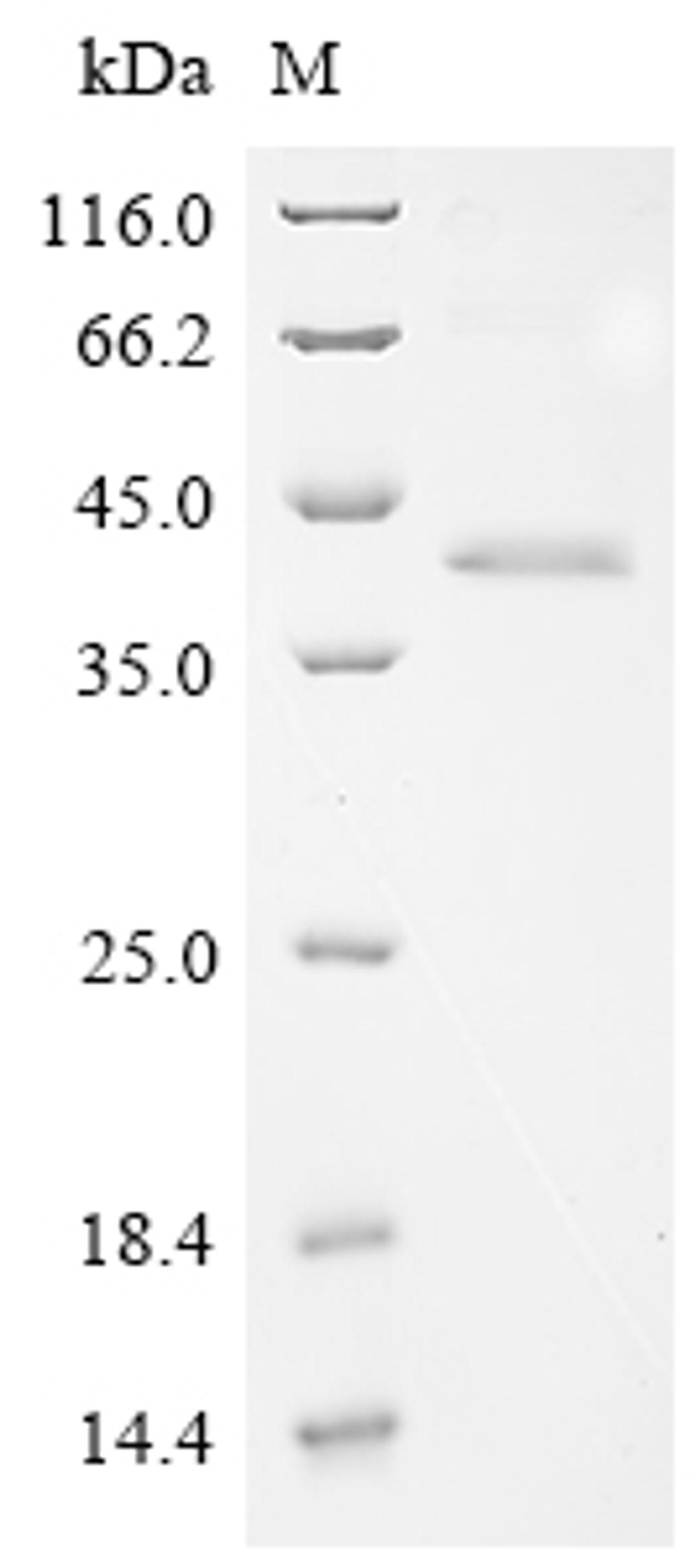 (Tris-Glycine gel) Discontinuous SDS-PAGE (reduced) with 5% enrichment gel and 15% separation gel.