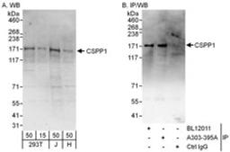 Detection of human CSPP1 by western blot and immunoprecipitation.