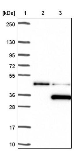 Western Blot: LYPLAL1 Antibody [NBP1-92090] - Lane 1: Marker [kDa] 250, 130, 95, 72, 55, 36, 28, 17, 10<br/>Lane 2: Negative control (vector only transfected HEK293T lysate)<br/>Lane 3: Over-expression lysate (Co-expressed with a C-terminal myc-DDK tag (~3.1 kDa) in mammalian HEK293T cells, LY408395)