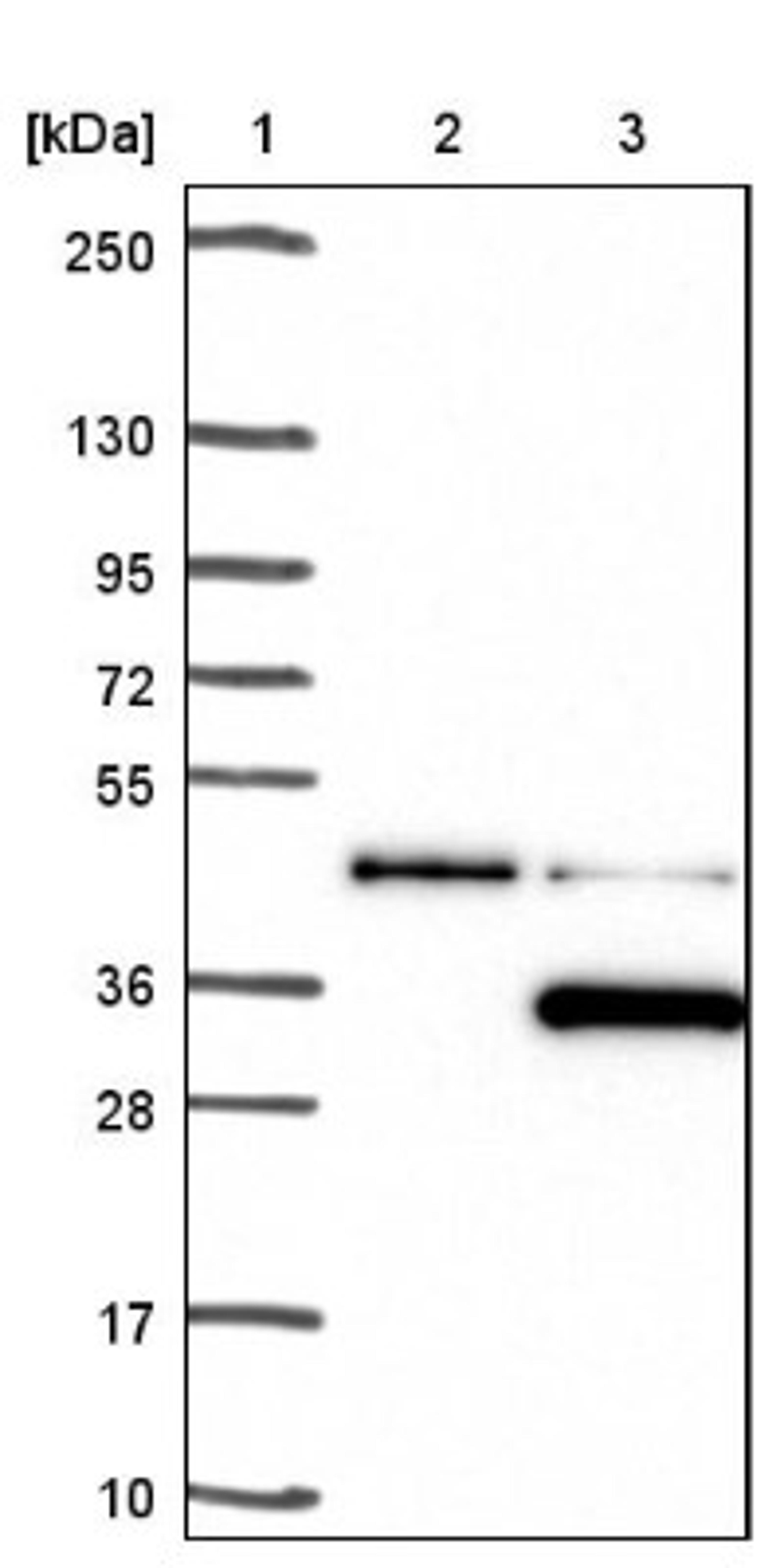 Western Blot: LYPLAL1 Antibody [NBP1-92090] - Lane 1: Marker [kDa] 250, 130, 95, 72, 55, 36, 28, 17, 10<br/>Lane 2: Negative control (vector only transfected HEK293T lysate)<br/>Lane 3: Over-expression lysate (Co-expressed with a C-terminal myc-DDK tag (~3.1 kDa) in mammalian HEK293T cells, LY408395)