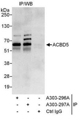 Detection of human ACBD5 by western blot of immunoprecipitates.