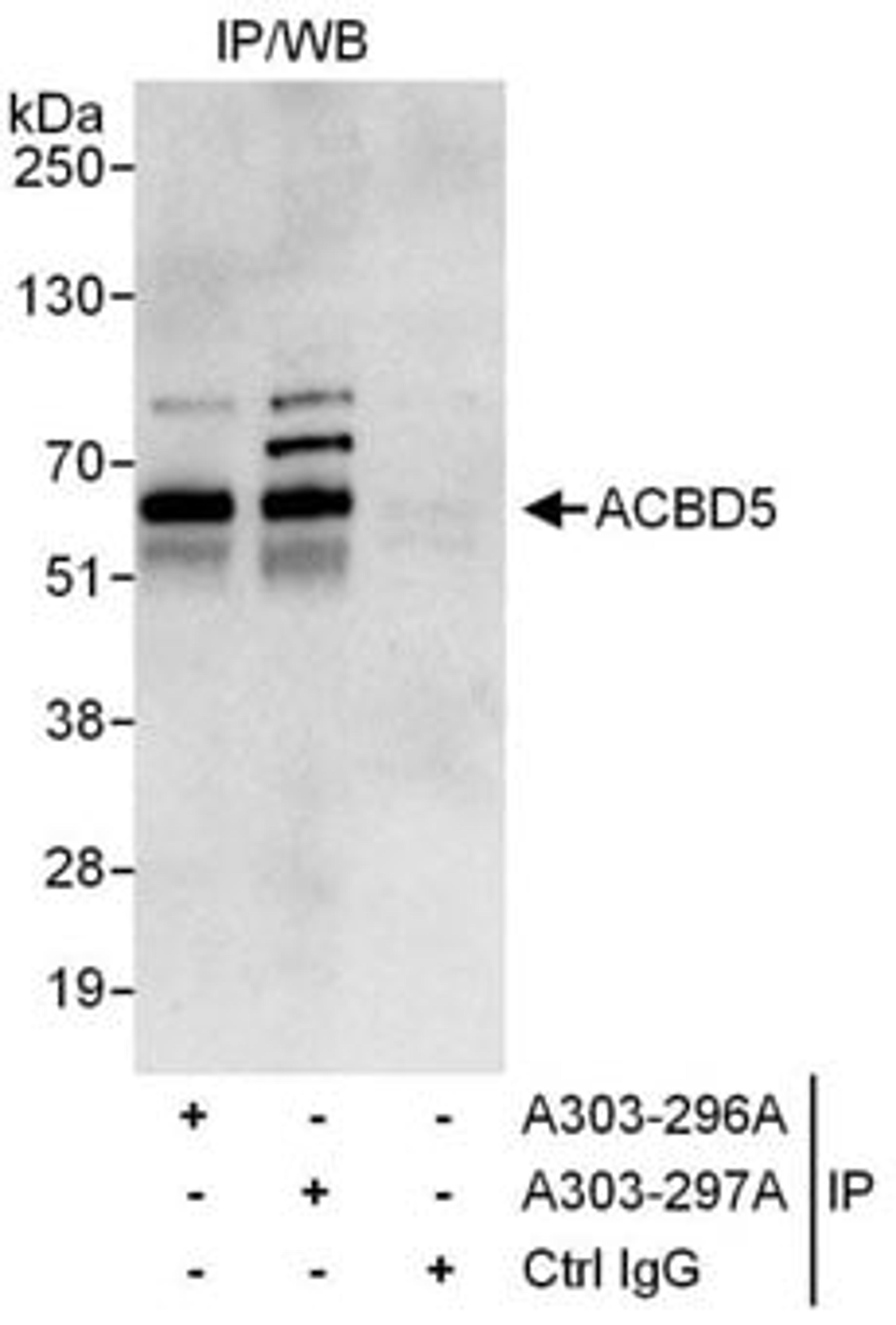 Detection of human ACBD5 by western blot of immunoprecipitates.