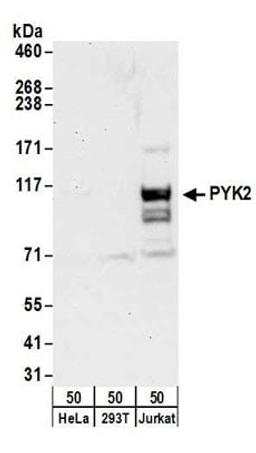 Detection of human PYK2 by western blot.