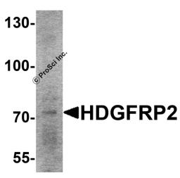 Western blot analysis of HDGFRP2 in rat lung tissue lysate with HDGFRP2 antibody at 2 &#956;g/mL .