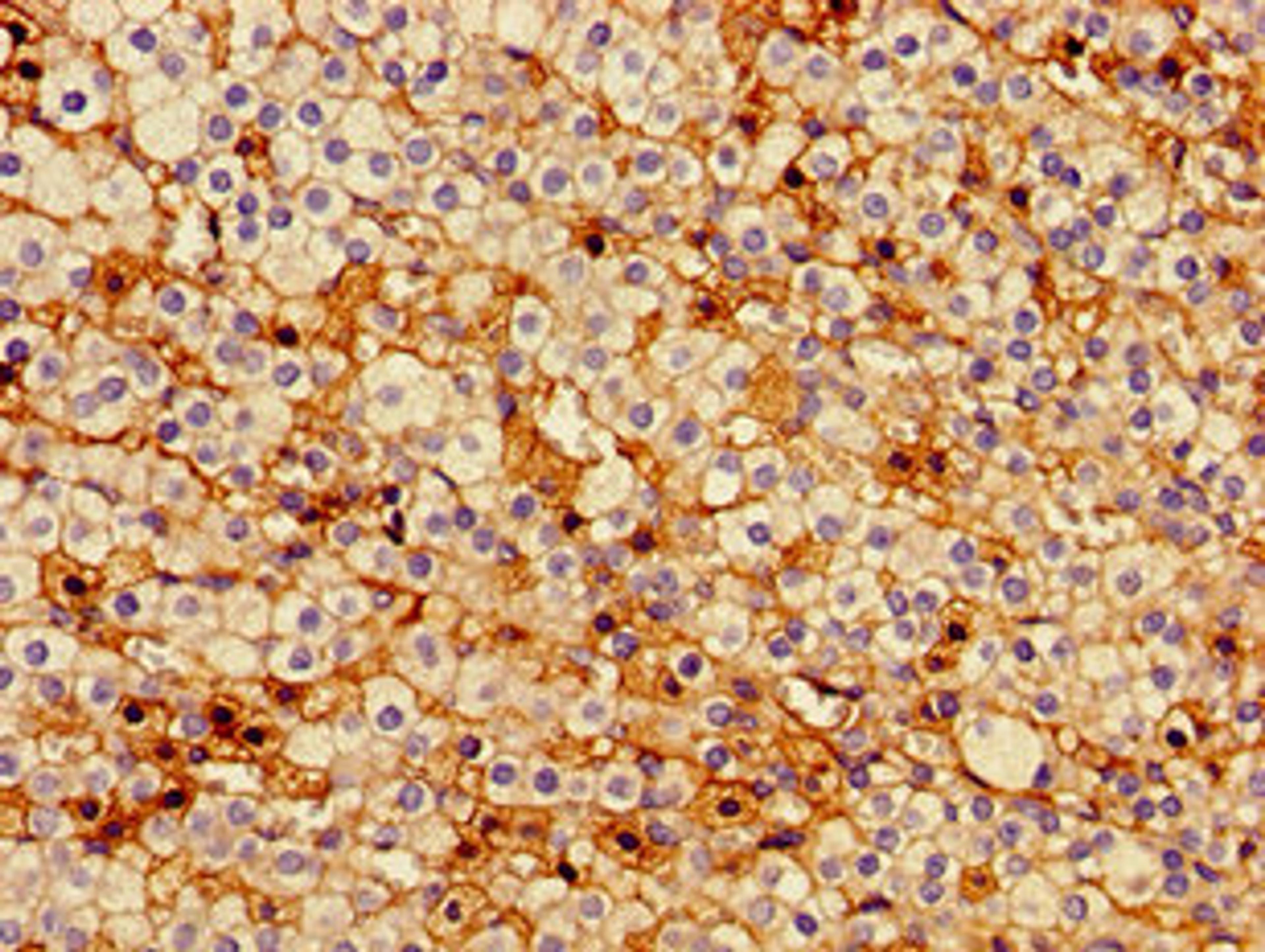 Immunohistochemistry of paraffin-embedded human adrenal gland tissue using CSB-PA00859A0Rb at dilution of 1:100