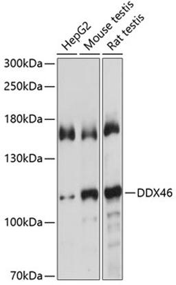 Western blot - DDX46 antibody (A4350)