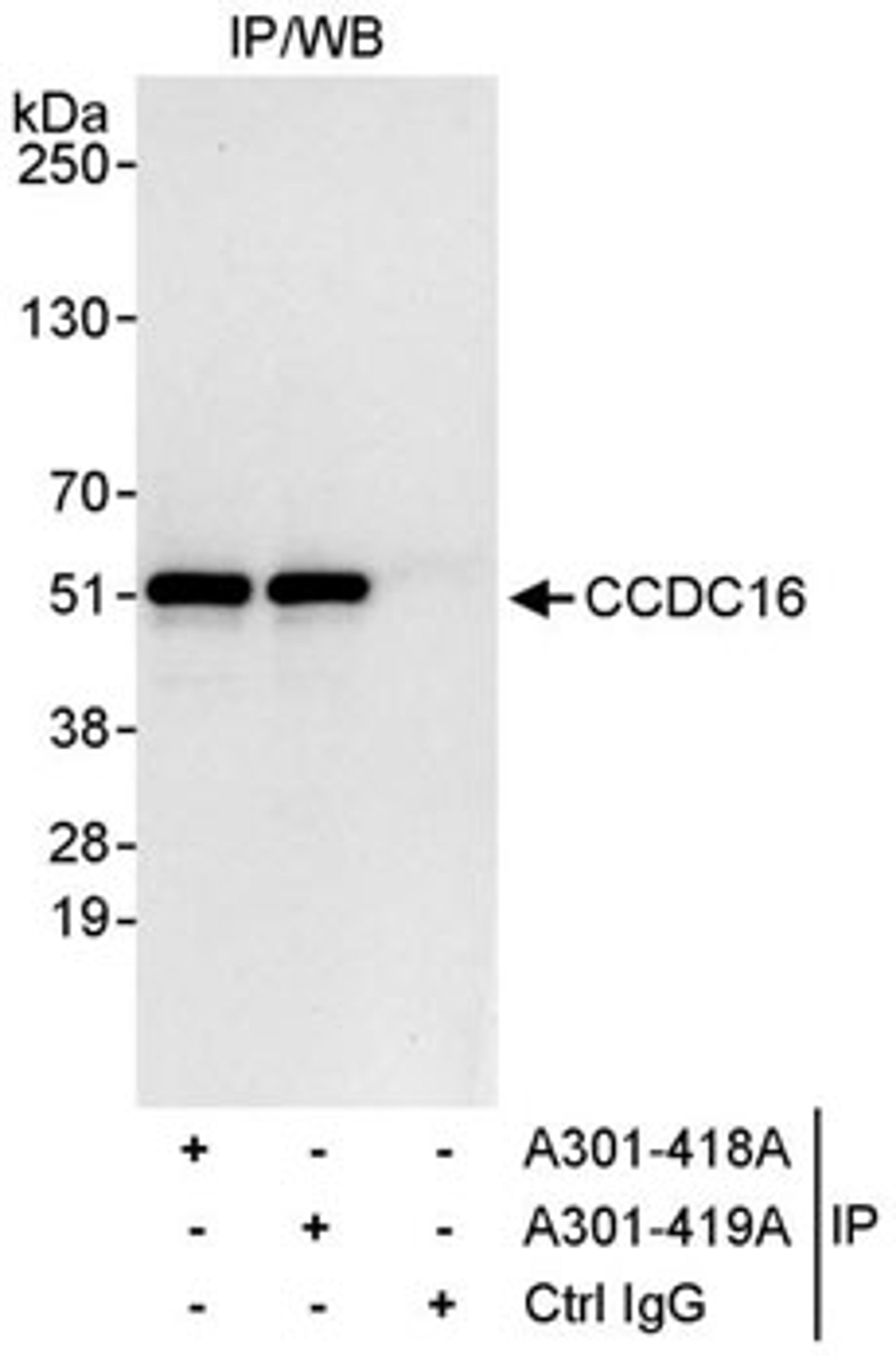 Detection of human CCDC16 by western blot of immunoprecipitates.