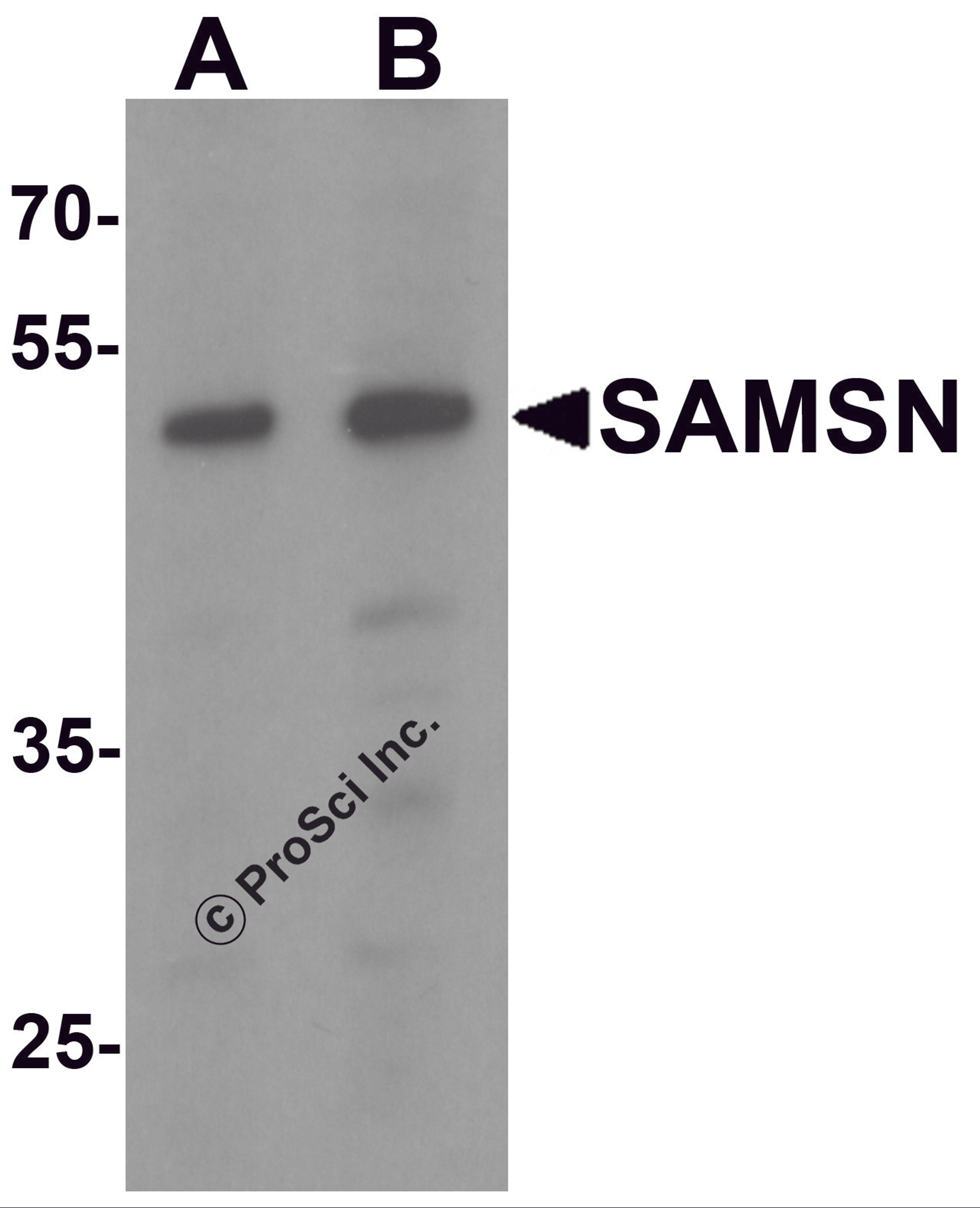 Western blot analysis of SAMSN in Hela cell lysate with SAMSN antibody at (A) 0.5 and (B) 1 &#956;g/mL.