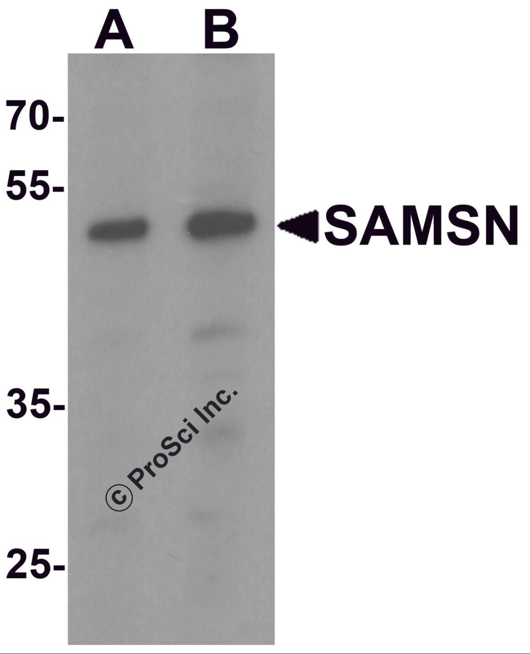 Western blot analysis of SAMSN in Hela cell lysate with SAMSN antibody at (A) 0.5 and (B) 1 μg/mL.