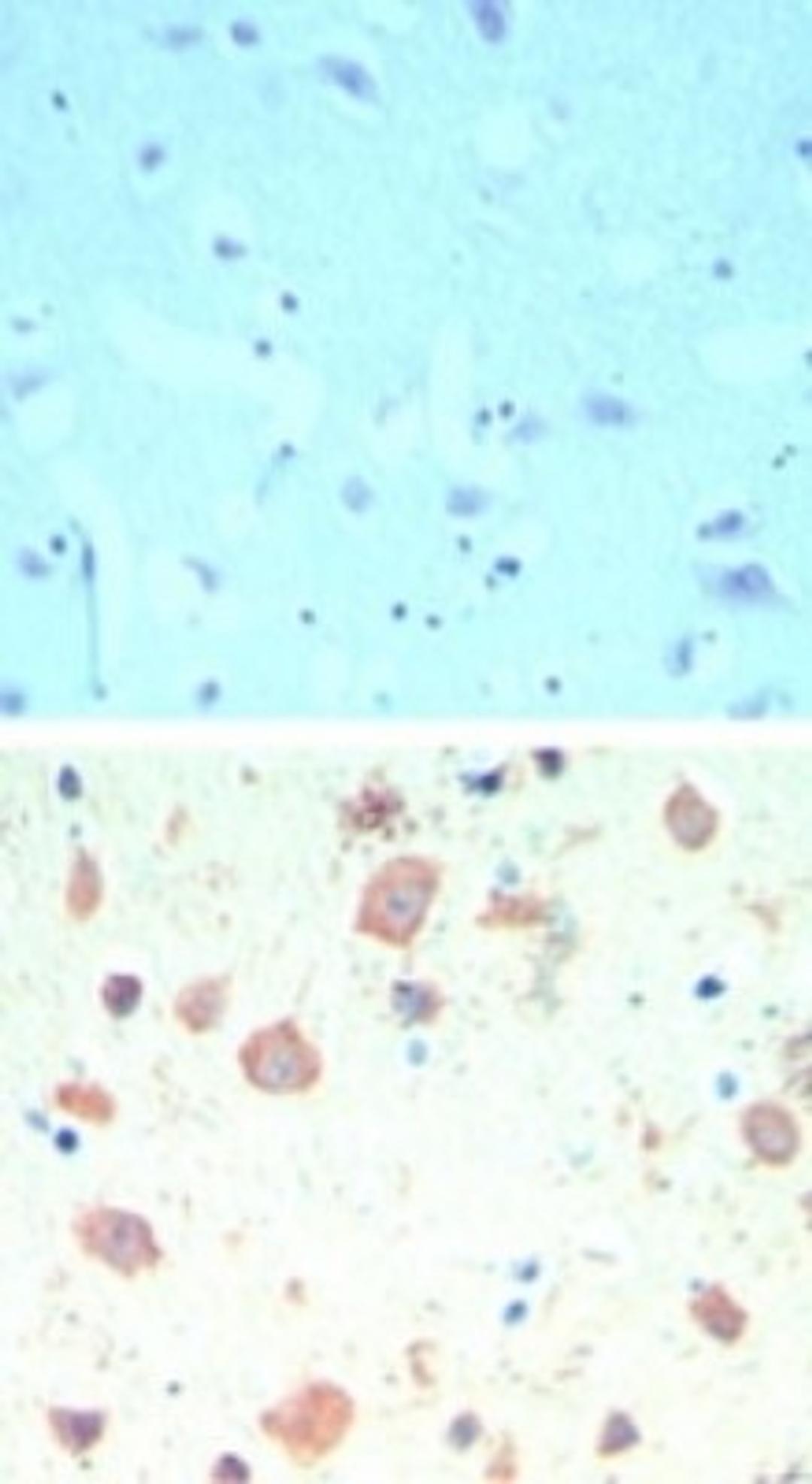 Immunohistochemistry-Paraffin: TIP60 Antibody [NBP2-24613] - analysis of TIP60 in formalin-fixed, paraffin-embedded human brain tissue using an isotype control (top) and this antibody (bottom) at 5 ug/ml.