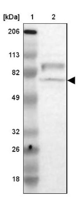 Western Blot: RAP1GAP Antibody [NBP1-83002] - Lane 1: Marker [kDa] 206, 113, 82, 49, 32, 26, 18<br/>Lane 2: Human cell line RT-4