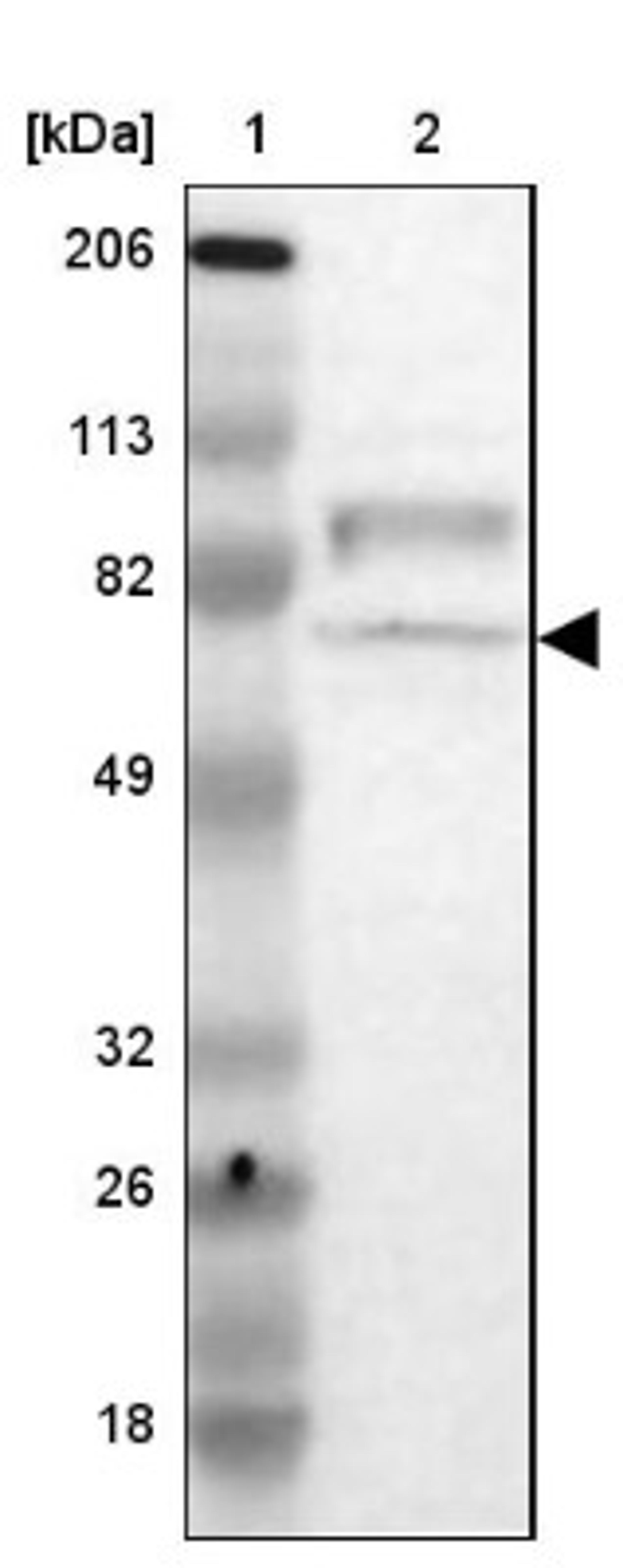 Western Blot: RAP1GAP Antibody [NBP1-83002] - Lane 1: Marker [kDa] 206, 113, 82, 49, 32, 26, 18<br/>Lane 2: Human cell line RT-4