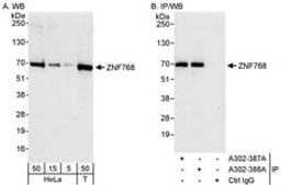 Detection of human ZNF768 by western blot and immunoprecipitation.