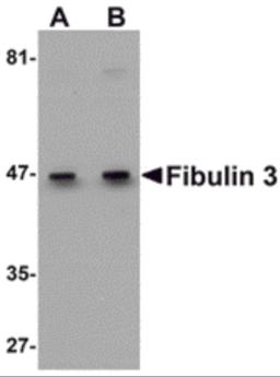 Western blot analysis of Fibulin 3 in HeLa cell lysate with Fibulin 3 antibody at (A) 0.5 and (B) 1 &#956;g/mL.