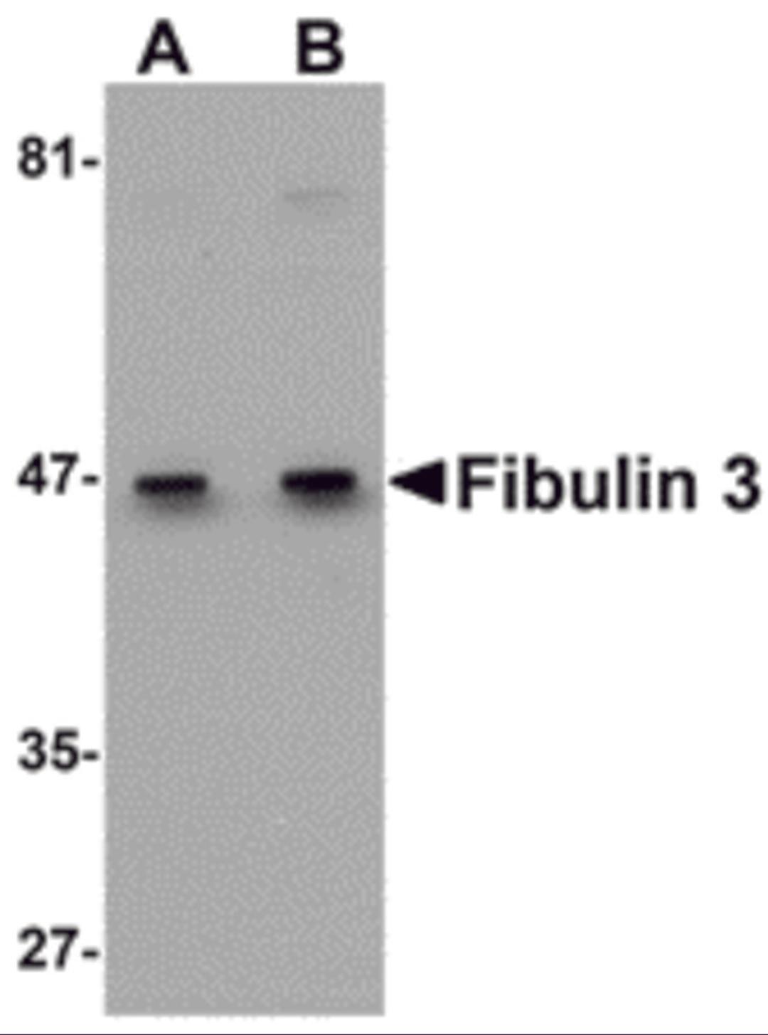 Western blot analysis of Fibulin 3 in HeLa cell lysate with Fibulin 3 antibody at (A) 0.5 and (B) 1 μg/mL.