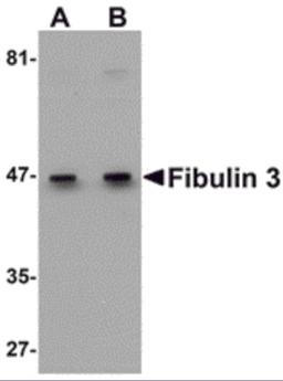 Western blot analysis of Fibulin 3 in HeLa cell lysate with Fibulin 3 antibody at (A) 0.5 and (B) 1 μg/mL.