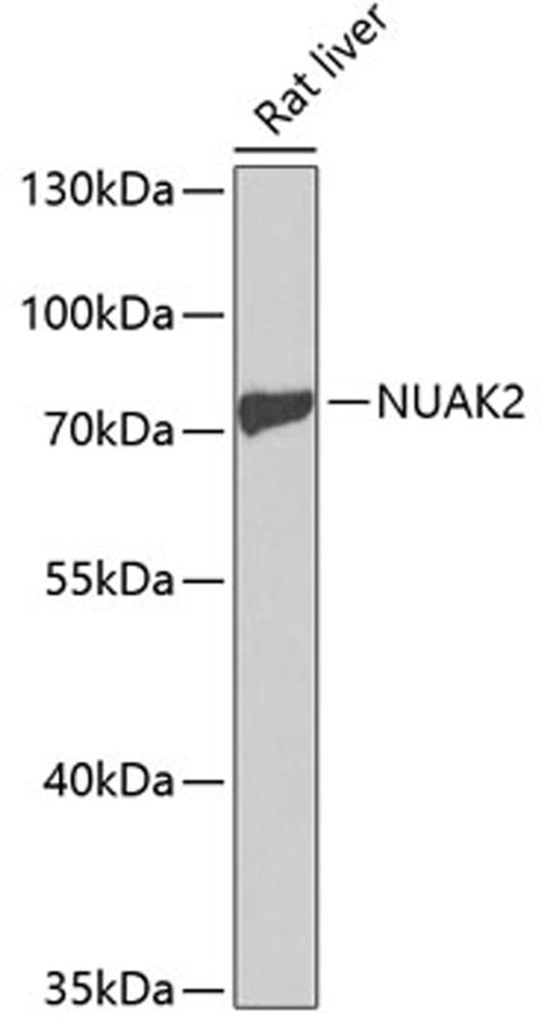 Western blot - NUAK2 antibody (A1079)