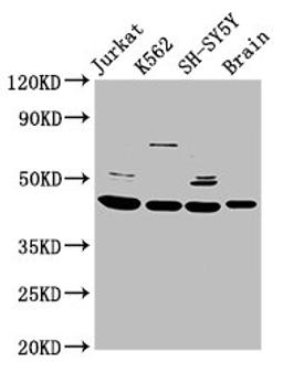 Western Blot. Positive WB detected in: Jurkat whole cell lysate, K562 whole cell lysate, SH-SY5Y whole cell lysate, Rat brain tissue. All lanes: HOXD3 antibody at 8.5ug/ml. Secondary. Goat polyclonal to rabbit IgG at 1/50000 dilution. Predicted band size: 46 kDa. Observed band size: 46 kDa. 