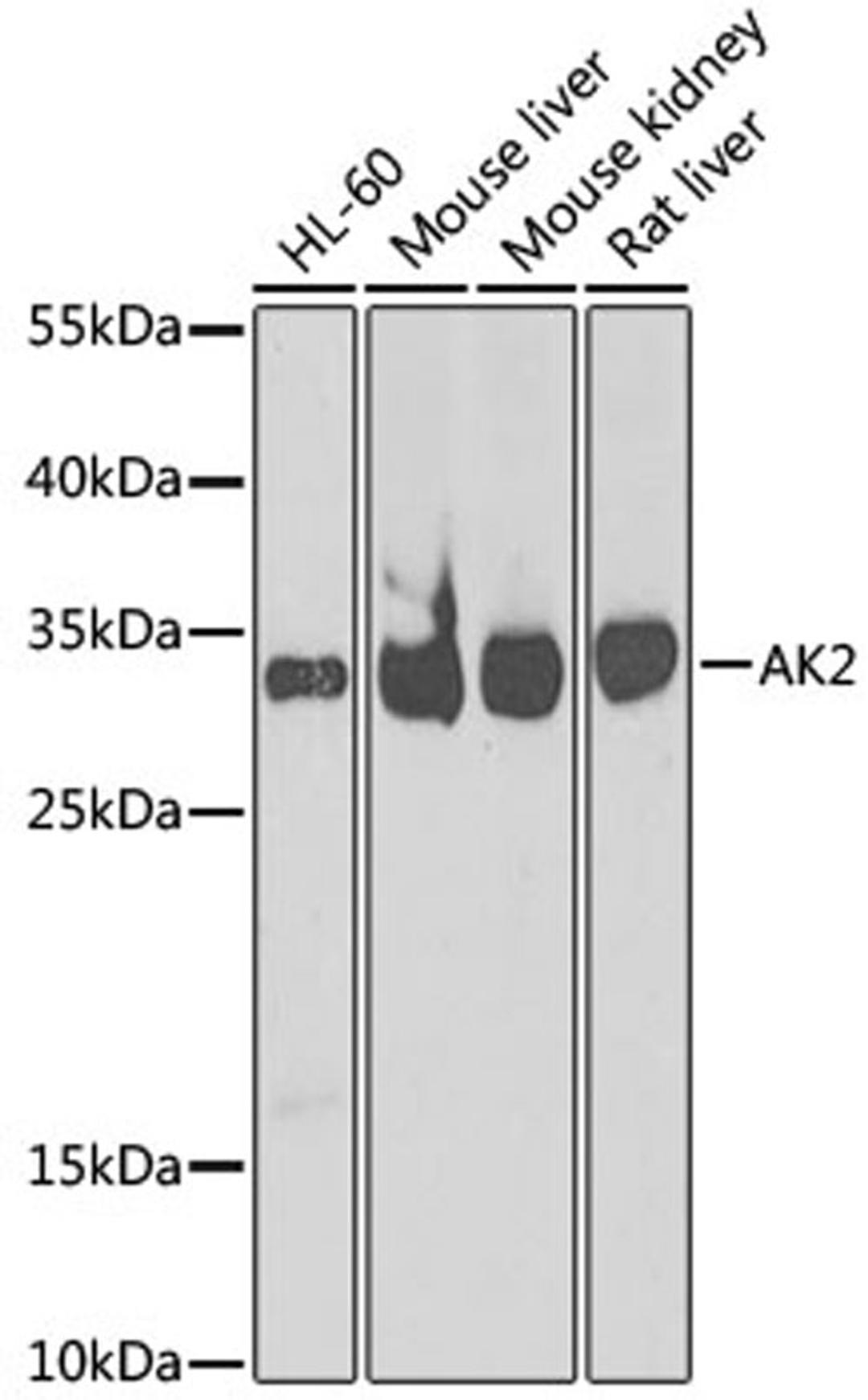 Western blot - AK2 antibody (A6519)