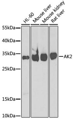 Western blot - AK2 antibody (A6519)