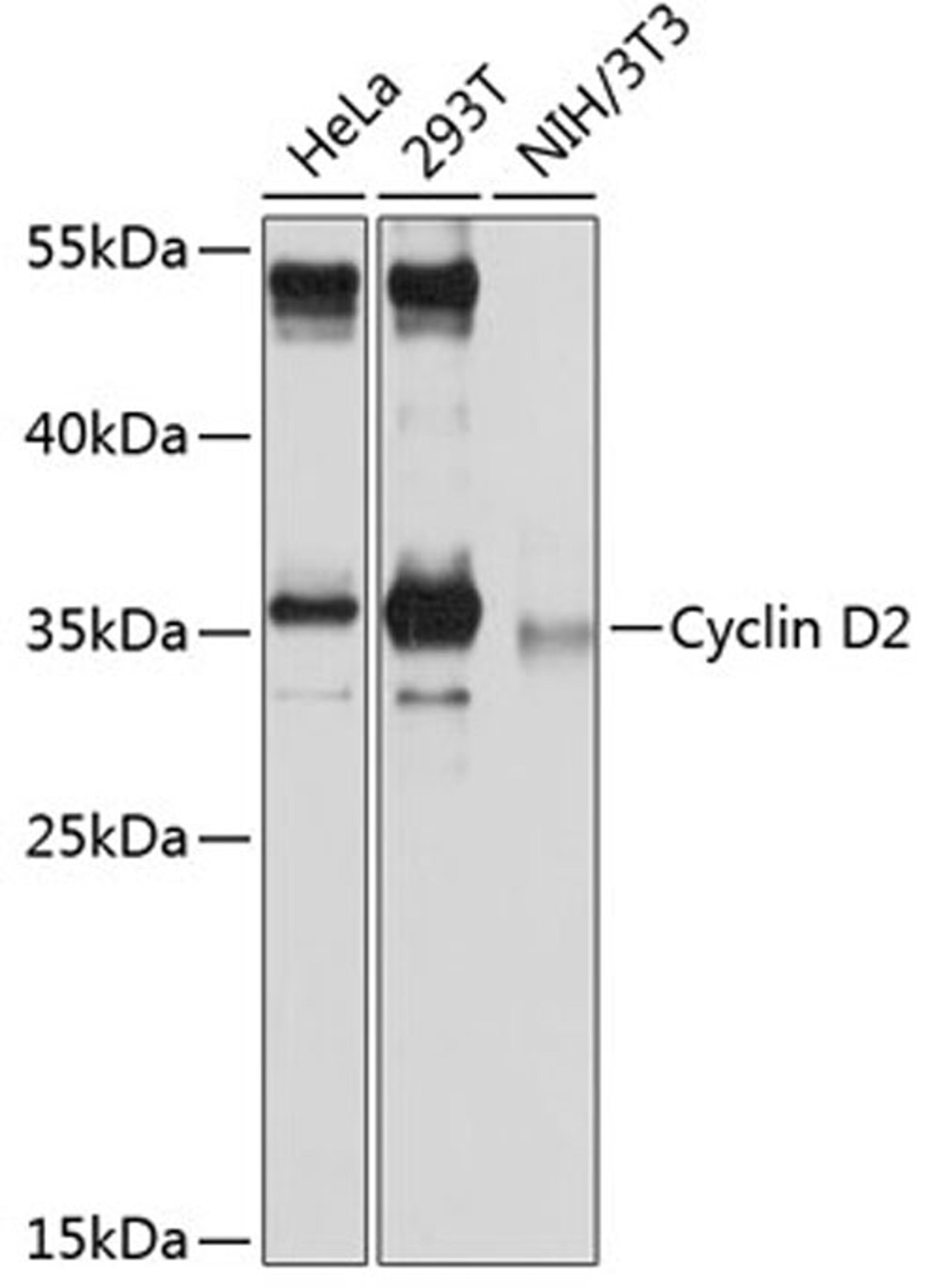 Western blot - Cyclin D2 antibody (A13284)