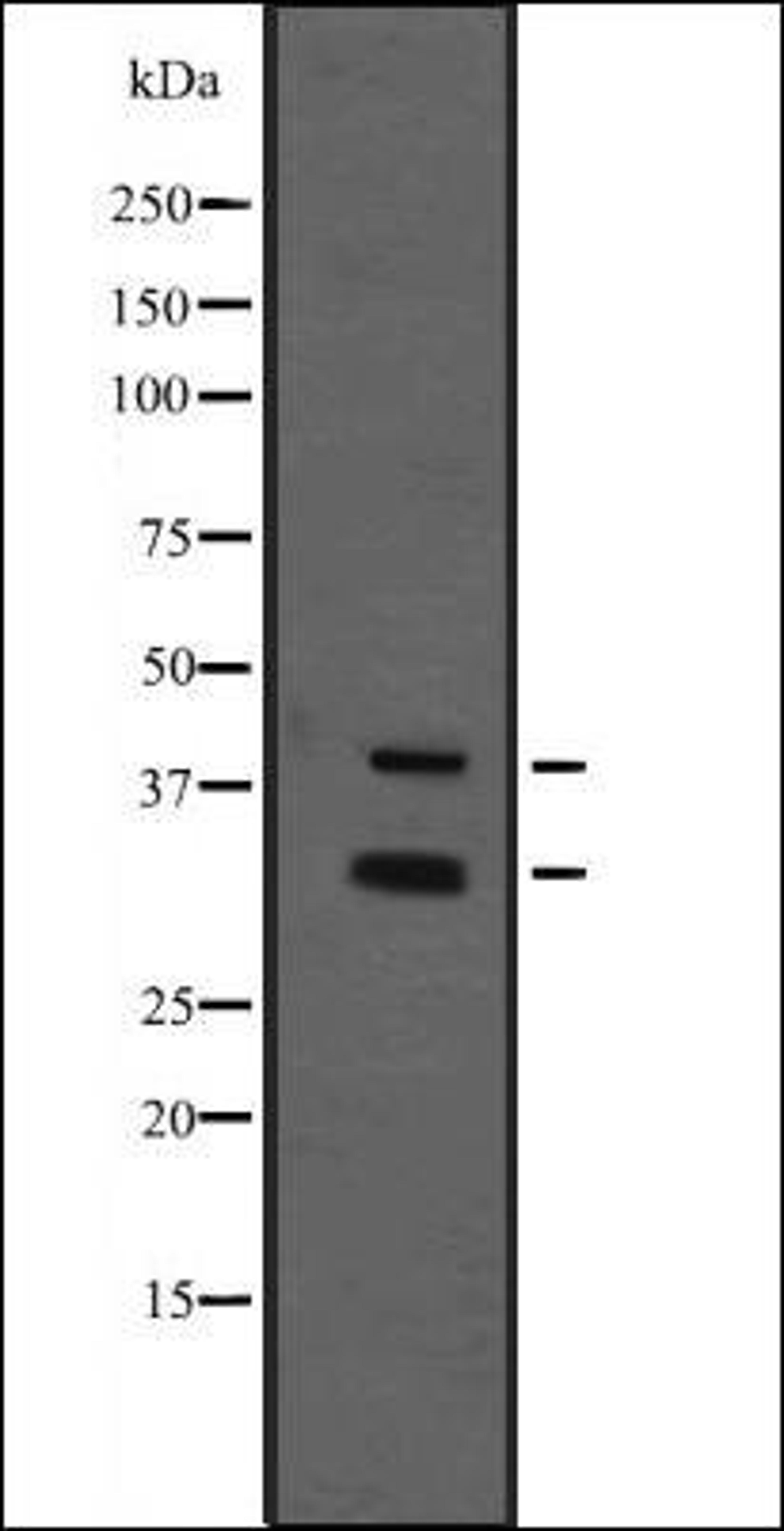 Western blot analysis of immunising recombinant protein using MIBP1 antibody