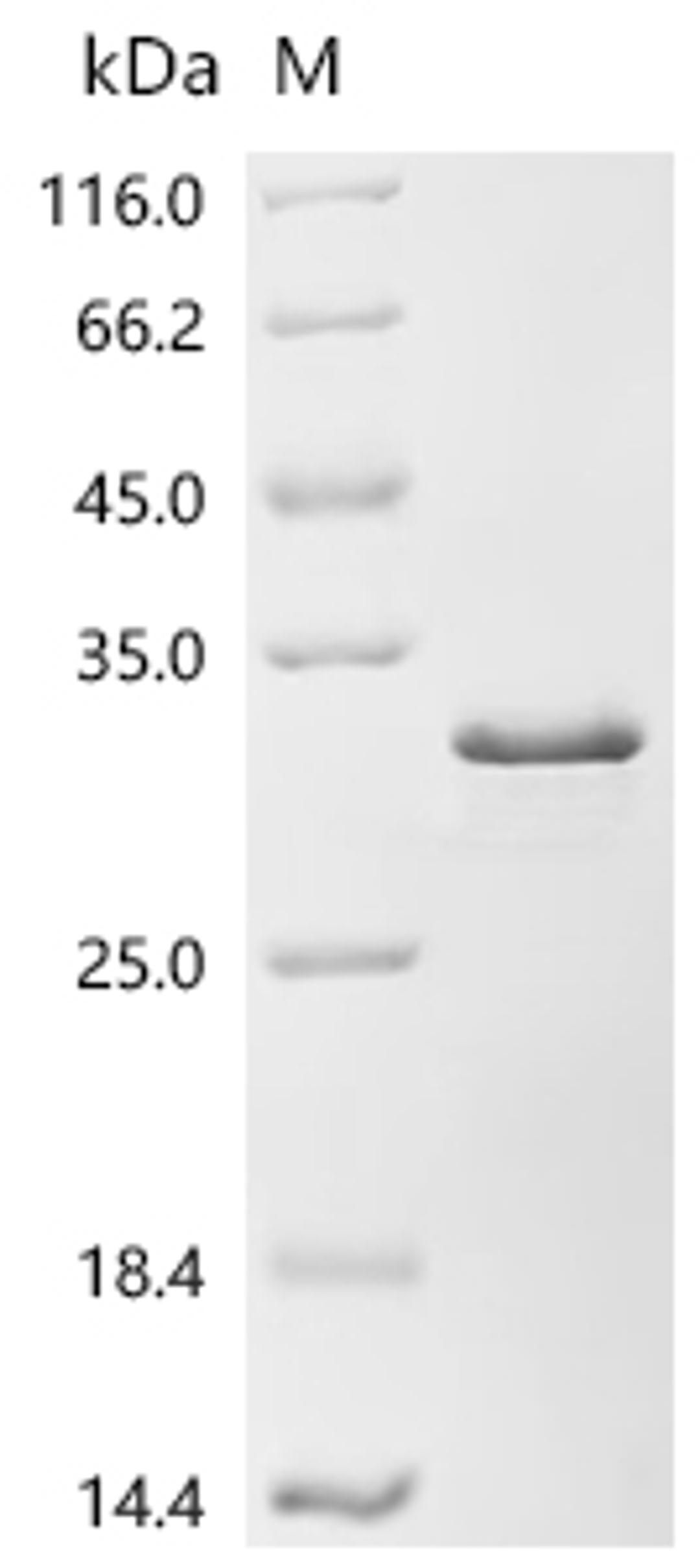 (Tris-Glycine gel) Discontinuous SDS-PAGE (reduced) with 5% enrichment gel and 15% separation gel.