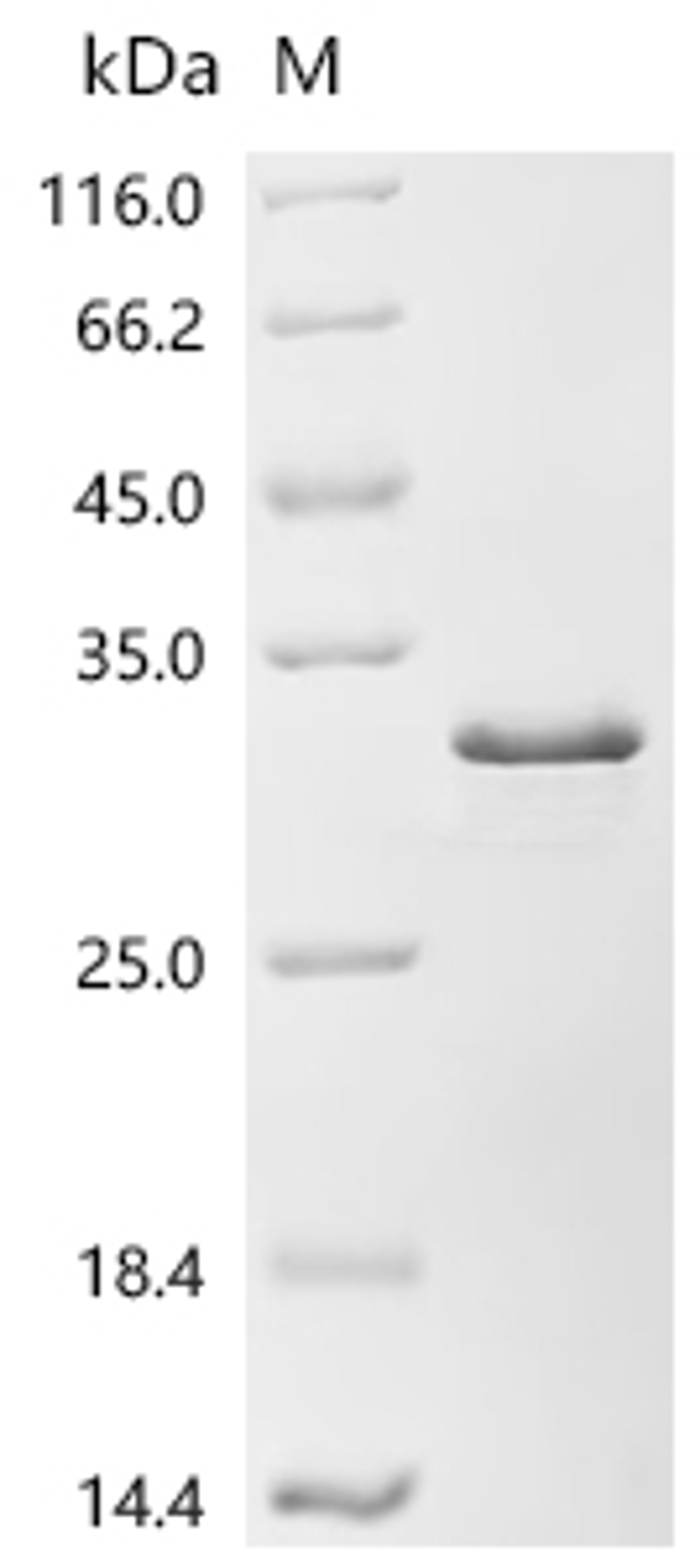 (Tris-Glycine gel) Discontinuous SDS-PAGE (reduced) with 5% enrichment gel and 15% separation gel.