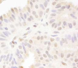 Detection of human MAML1 by immunohistochemistry.