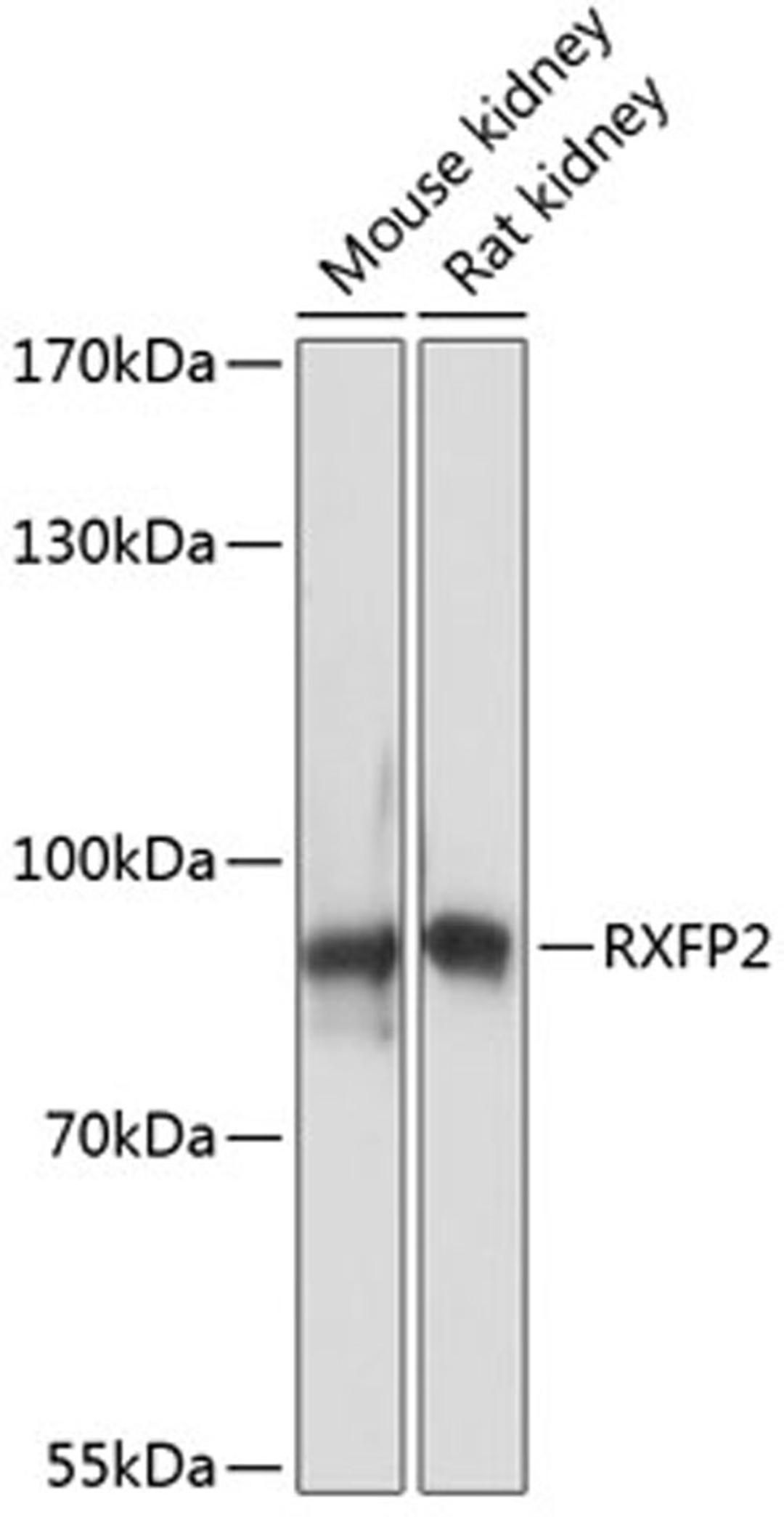 Western blot - RXFP2 antibody (A14301)