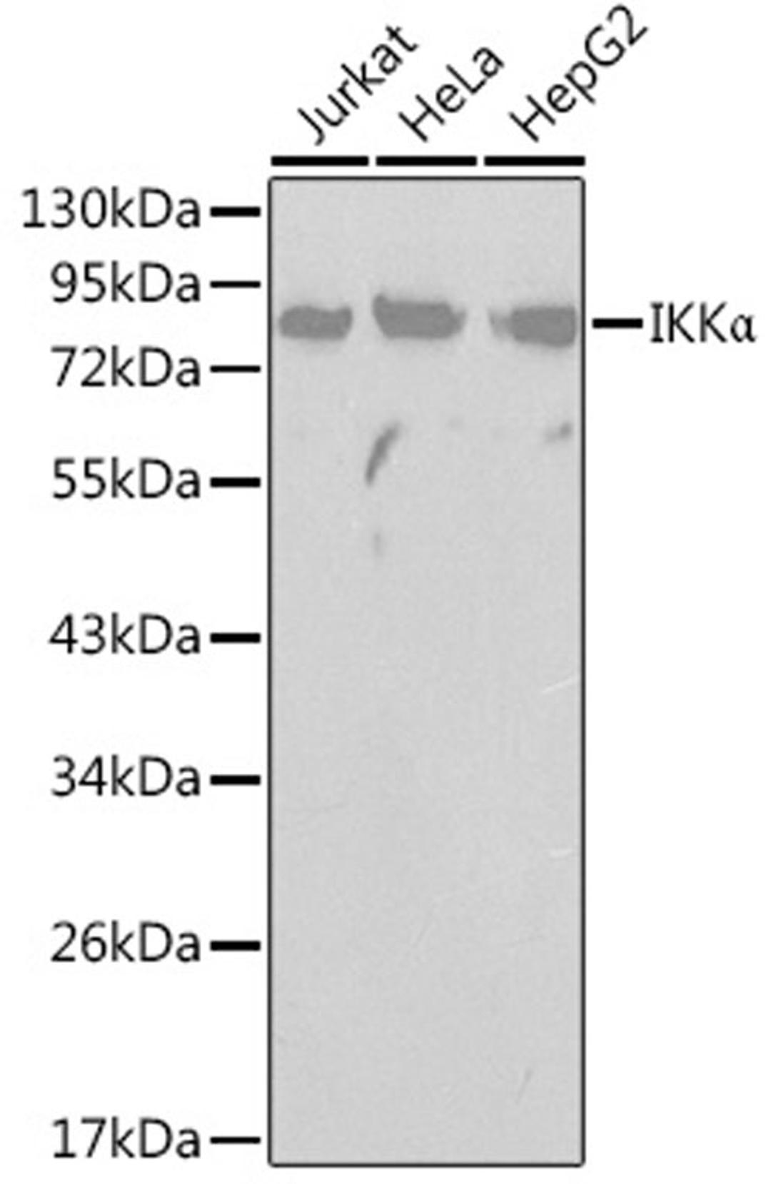 Western blot - IKKa antibody (A0423)