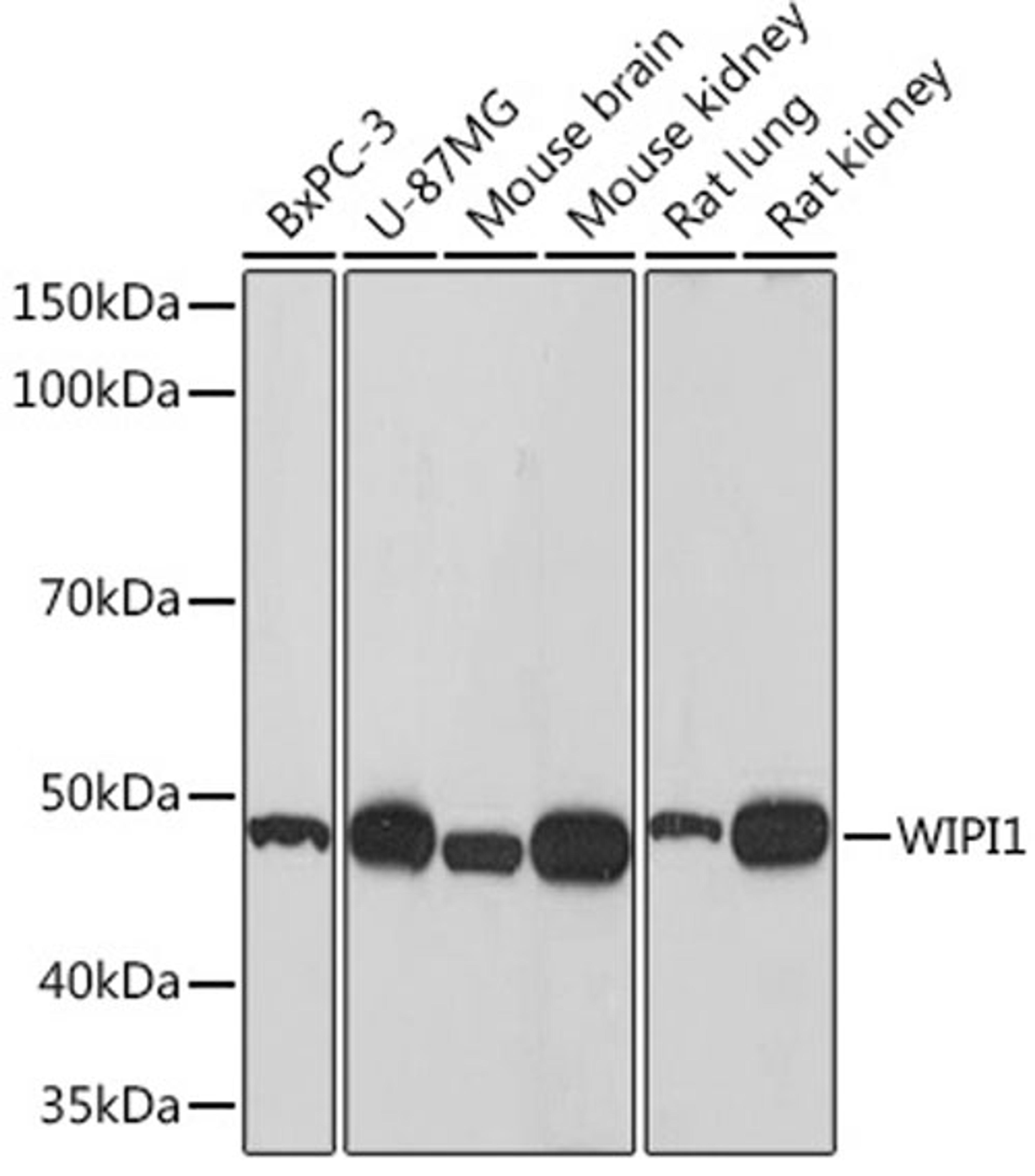 Western blot - WIPI1 Rabbit mAb (A9600)