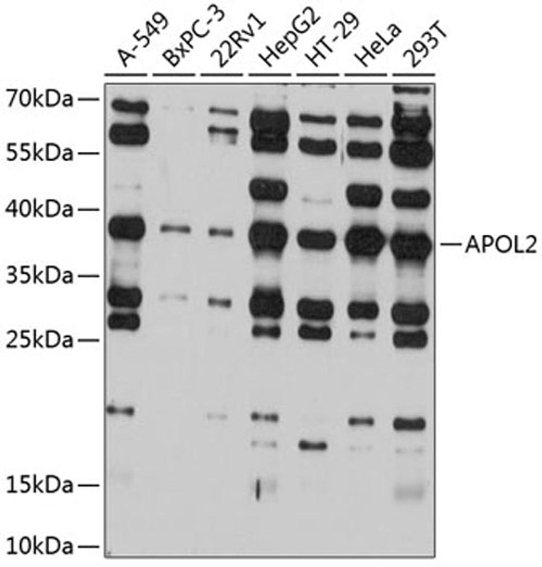 Western blot - APOL2 antibody (A12202)