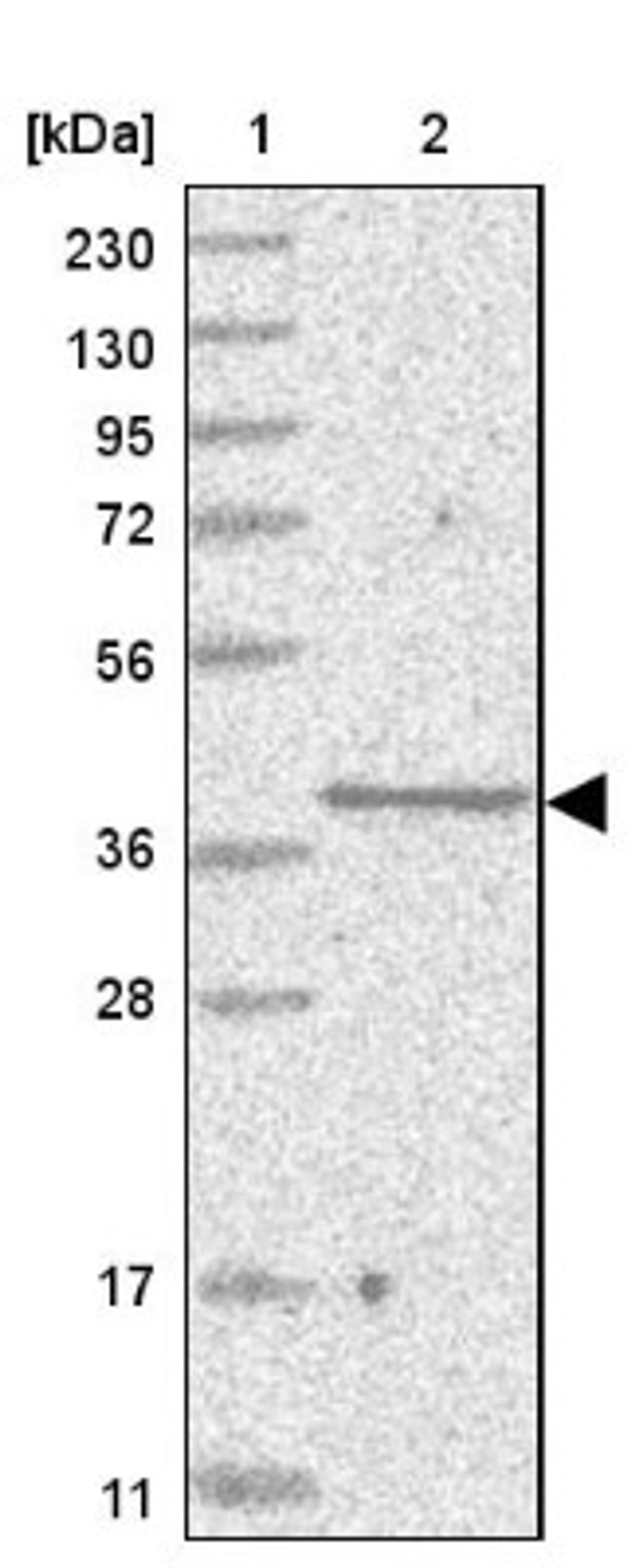 Western Blot: SLC35A5 Antibody [NBP1-83636] - Lane 1: Marker [kDa] 230, 130, 95, 72, 56, 36, 28, 17, 11<br/>Lane 2: Human cell line RT-4