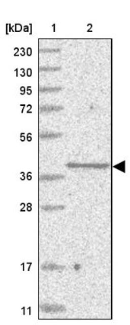 Western Blot: SLC35A5 Antibody [NBP1-83636] - Lane 1: Marker [kDa] 230, 130, 95, 72, 56, 36, 28, 17, 11<br/>Lane 2: Human cell line RT-4