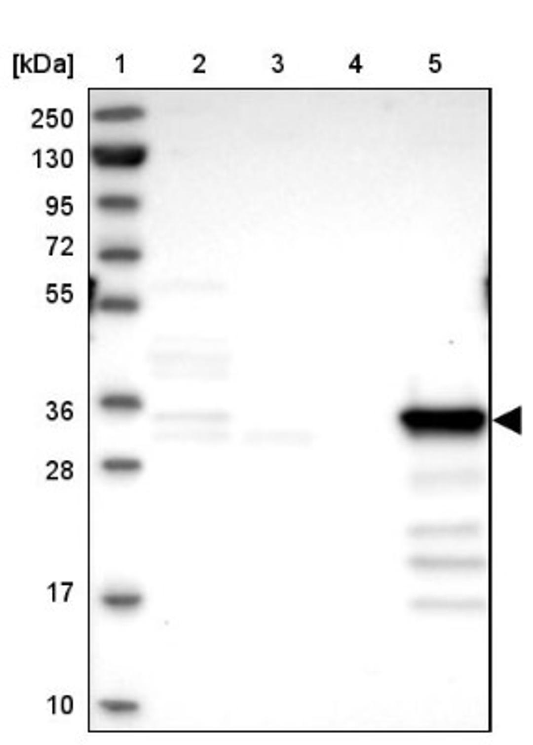 Western Blot: SULT2A1 Antibody [NBP2-32604] - Lane 1: Marker [kDa] 250, 130, 95, 72, 55, 36, 28, 17, 10<br/>Lane 2: Human cell line RT-4<br/>Lane 3: Human cell line U-251MG sp<br/>Lane 4: Human plasma (IgG/HSA depleted)<br/>Lane 5: Human liver tissue