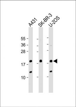 Western Blot at 1:2000 dilution Lane 1: A431 whole cell lysate Lane 2: SK-BR-3 whole cell lysate Lane 3: U-2OS whole cell lysate Lysates/proteins at 20 ug per lane.