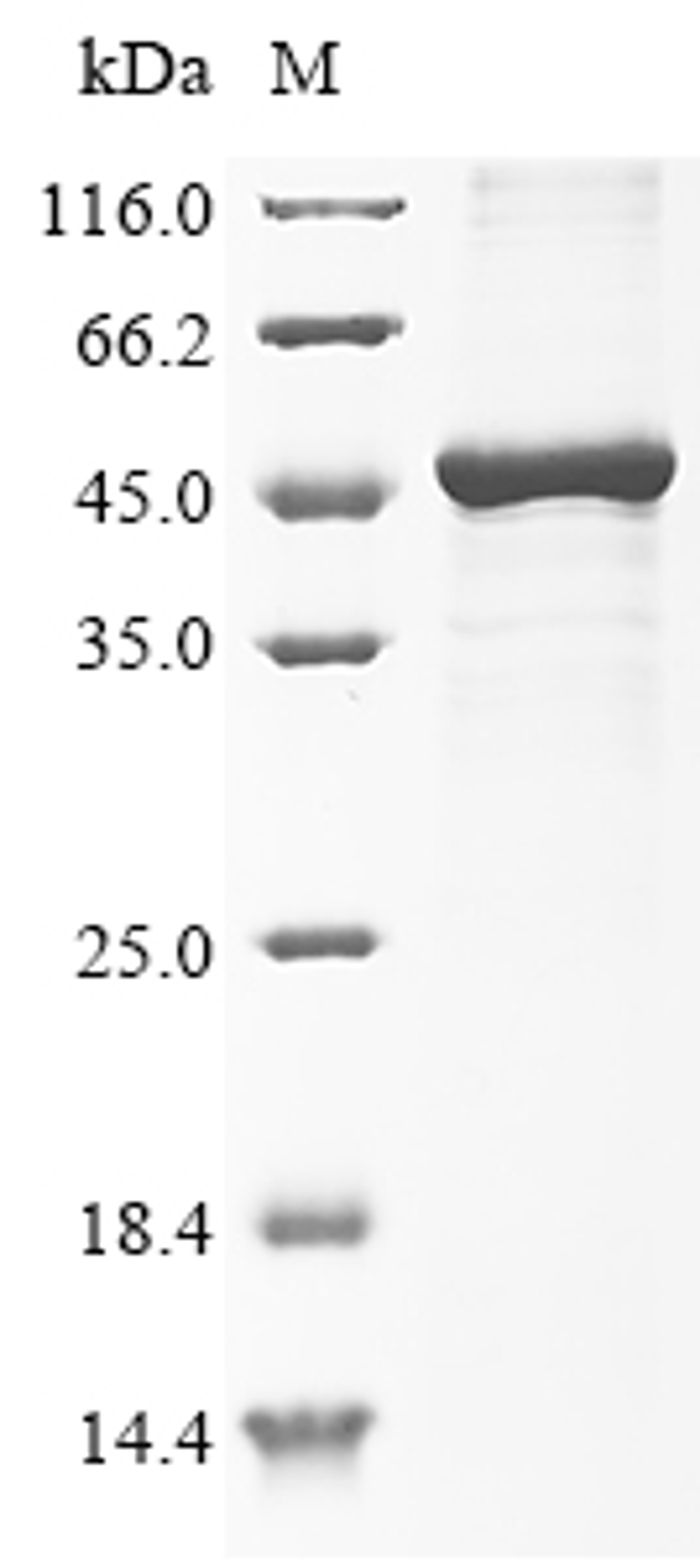 (Tris-Glycine gel) Discontinuous SDS-PAGE (reduced) with 5% enrichment gel and 15% separation gel.