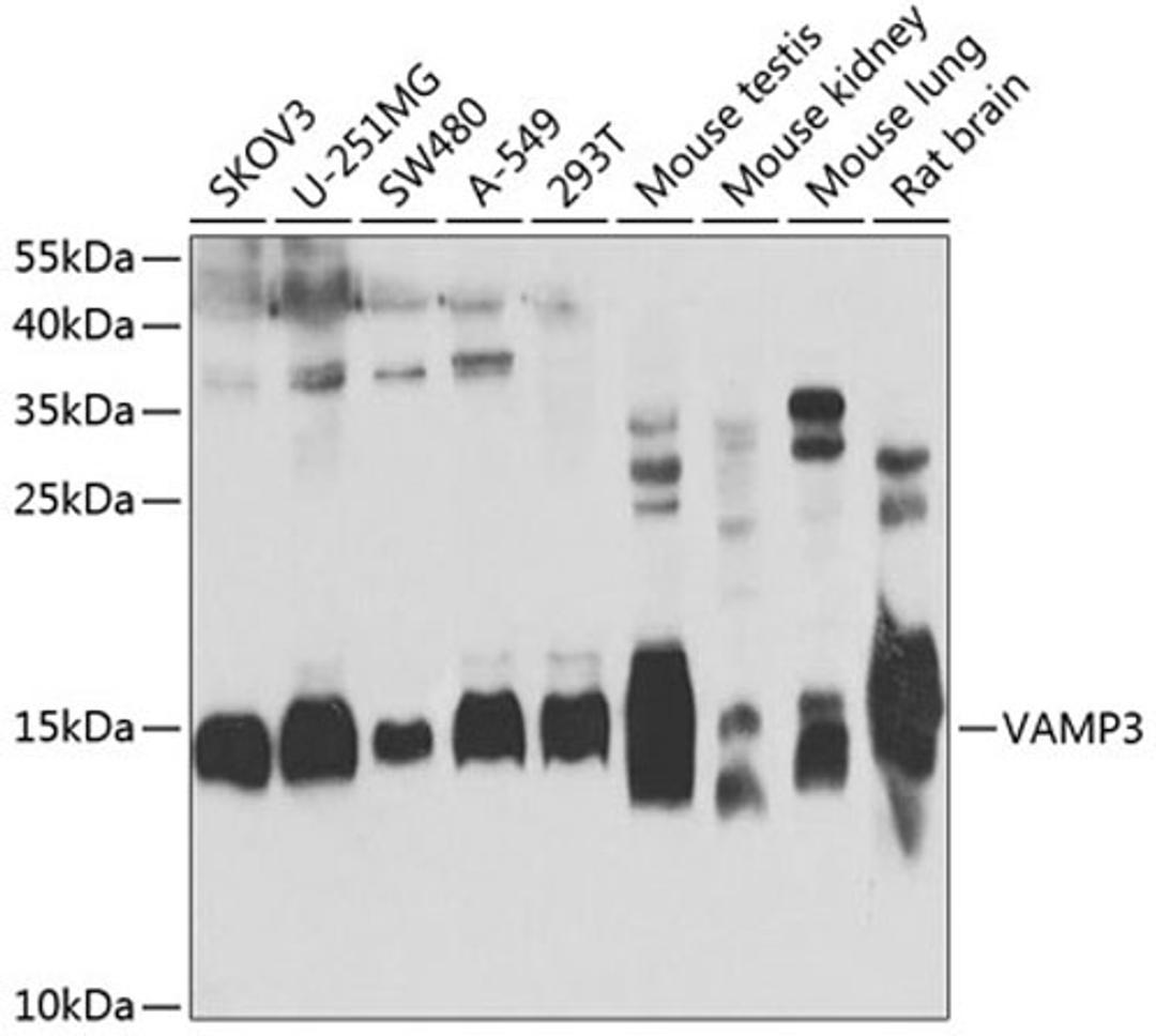 Western blot - VAMP3 antibody (A7457)