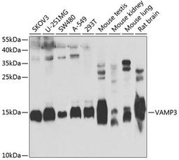 Western blot - VAMP3 antibody (A7457)