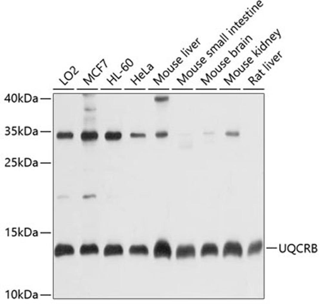 Western blot - UQCRB antibody (A1273)