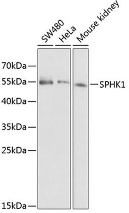 Western blot - SPHK1 antibody (A0139)