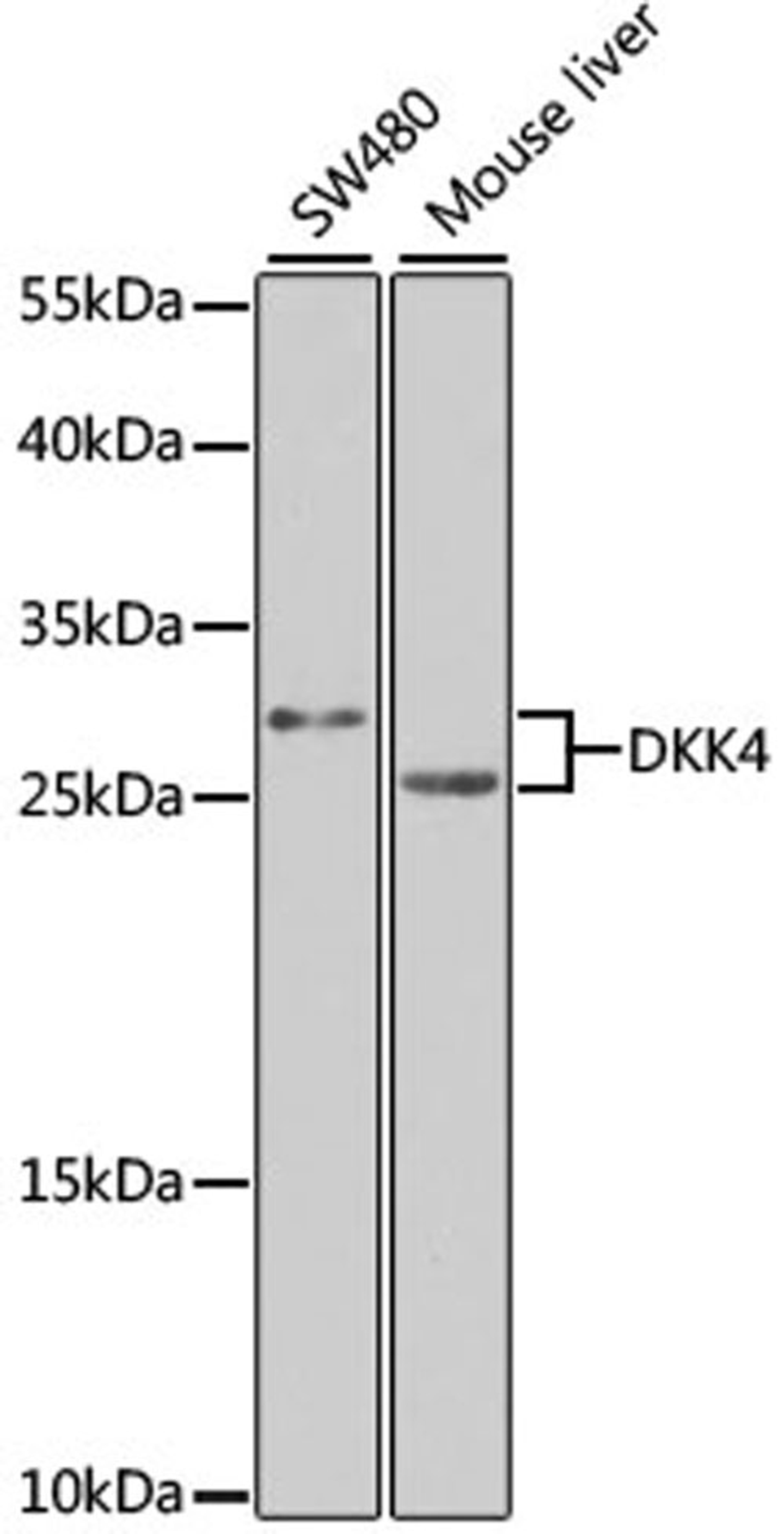 Western blot - DKK4 antibody (A7797)