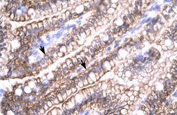 Antibody used in IHC on Human Intestine.