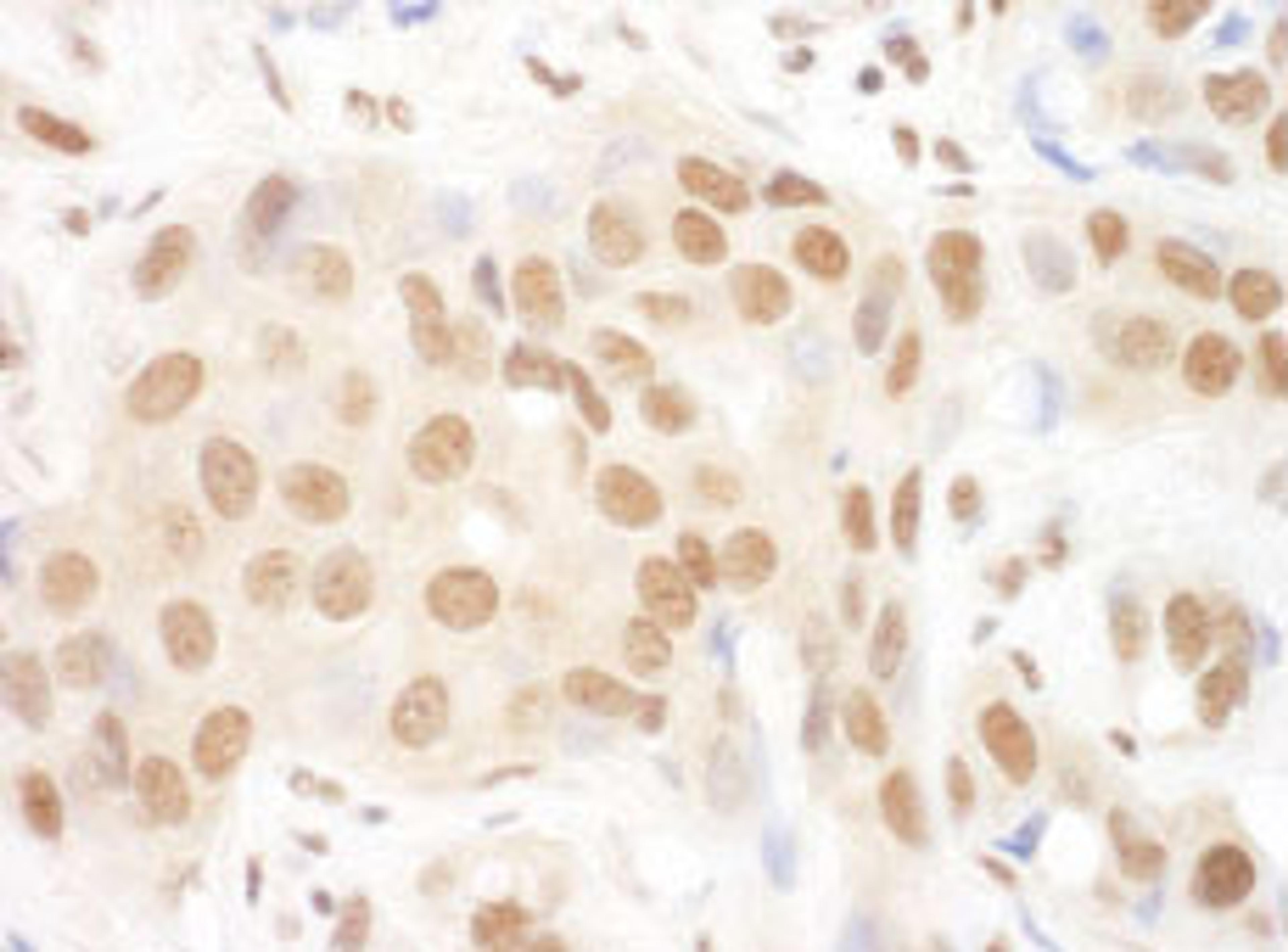 Detection of human DGCR8 by immunohistochemistry.