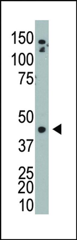 Antibody is used in Western blot to detect ADK in mouse bladder tissue lysate.